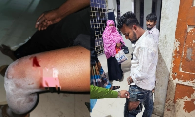 পাগলা কুকুরের কামড়ে আহত ২৬