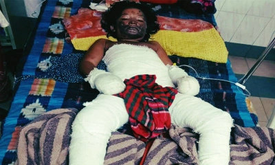 আগুন পোহাতে গিয়ে শিক্ষার্থী দগ্ধ