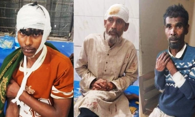 আ.লীগ কর্মীদের হামলায় ৫ বিএনপি নেতাকর্মী আহত
