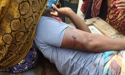 চাঁদার দাবিতে যুবককে হাতুড়ি দিয়ে পিটিয়ে জখম