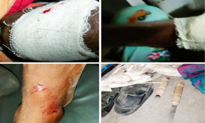 দুর্বৃত্তের হামলায় মোটরসাইকেল ছিনতাই