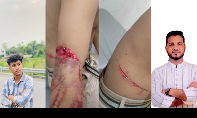 আনোয়ারায় ছাত্রদলের বিরুদ্ধে কিশোরকে কুপিয়ে জখমের অভিযোগ