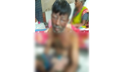 ঘুমন্ত স্বামীর মুখে গরম পানি নিক্ষেপ স্ত্রীর