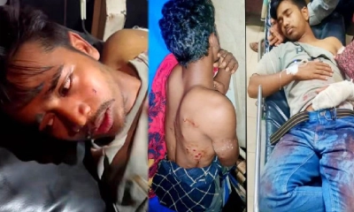 চট্টগ্রামে দুর্বৃত্তের গুলিতে দুই টমটমচালক আহত