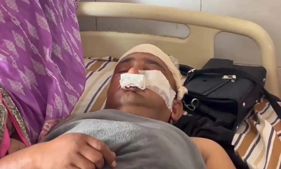 আসামি ধরতে গিয়ে মারধরের শিকার দুই পুলিশ সদস্য