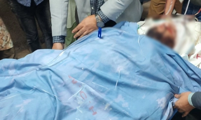 খুলে রাখা হয়েছে ওসমান হাদির মাথার খুলির একটি বড় অংশ