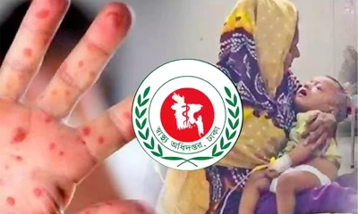 হাম ও উপসর্গে আরও ৭ মৃত্যু
