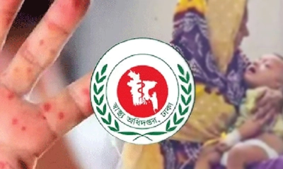 হাম ও উপসর্গে আরও ৬ শিশুর মৃত্যু