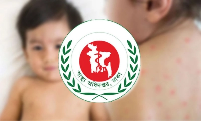 হাম ও উপসর্গে আরও ৬ শিশুর মৃত্যু, প্রাণহানি ছাড়াল ৮০০