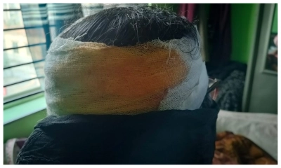 রাজধানীতে জামায়াতের নারী নেত্রীর ওপর হামলা
