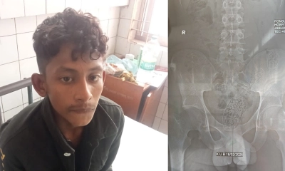 যশোরে যুবকের পেট থেকে ২২ শ ইয়াবা উদ্ধার 