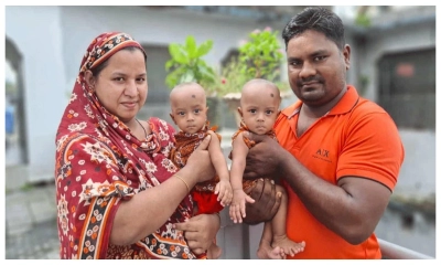 সফল সার্জারির শেষে বাড়ি ফিরছে জোড়া লাগা শিশু জুহি-রুহি