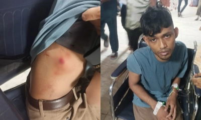 রাজধানীতে দুর্বৃত্তের গুলিতে যুবক আহত