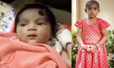 ট্রাকের চাকার চাপে পেঠ ফেট জন্ম নেয়া ফাতমা জানে না তার বাবা-মা বেঁচে নেই
