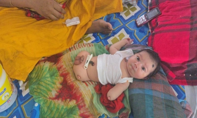 নেই দুই পা, একটি হাত অর্ধেক—শিশুর জন্ম, অতঃপর…