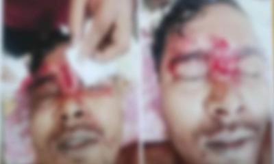 রূপগঞ্জে ব্যবসায়ীর বাড়িতে হামলা, আহত ২