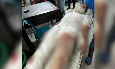ছাত্রলীগ ও যুবদল নেতার গুলি-কোপে বৃদ্ধ আহত