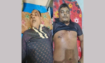 ফুটবল খেলাকে কেন্দ্র করে দু’পক্ষের মধ্যে সংঘর্ষ। ছবি- রূপালী বাংলাদেশ