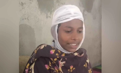 আহত ছাত্রী সাইদা বেগম।  ছবি- সংগৃহীত