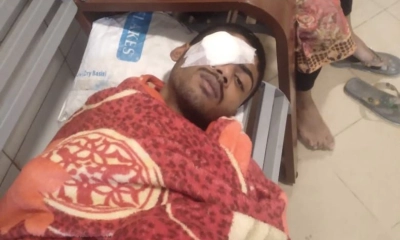মুক্তিপণ না পেয়ে চোখ  উপড়ে হত্যাচেষ্টা