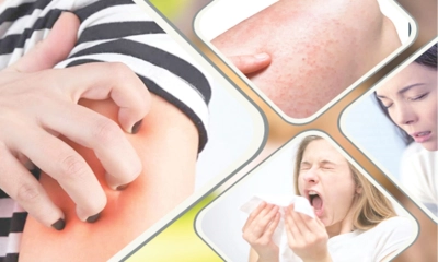 ত্বকে লুকিয়ে থাকে  ডাস্ট মাইট অ্যালার্জি