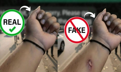 এআই দিয়ে তৈরি জখম  হাতের ছবি দেখিয়ে ছুটি  নিলেন অফিসকর্মী