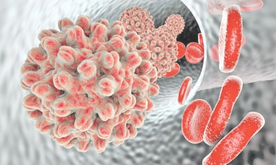 ভাইরাল হেপাটাইটিসের  লক্ষণ ও প্রতিকার