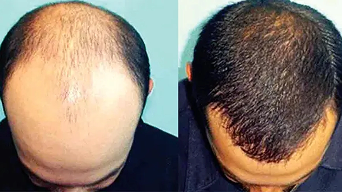 ছবি- সংগৃহীত