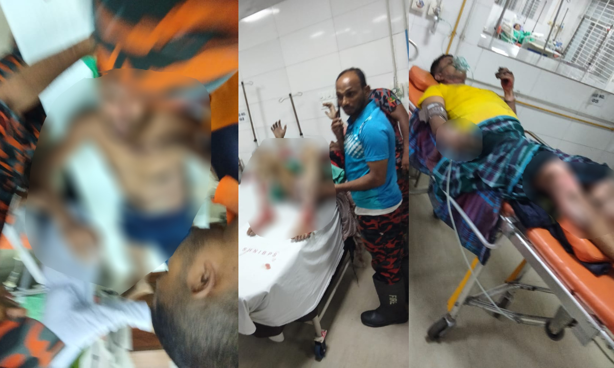 টঙ্গীতে অগ্নিকাণ্ডের ঘটনায় দগ্ধদের হাসপাতালে নেওয়া হয়েছে। ছবি- রূপালী বাংলাদেশ