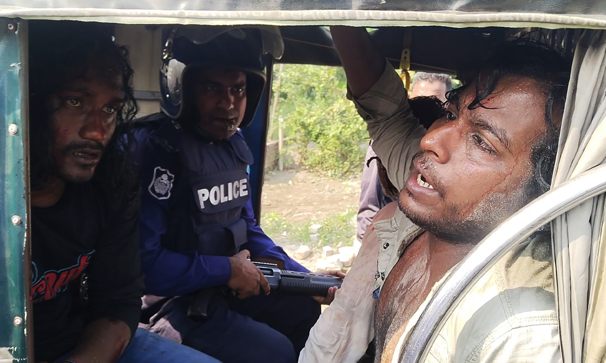 সংঘর্ষে  আহত বাউল সমর্থক।  ছবি- রূপালী বাংলাদেশ