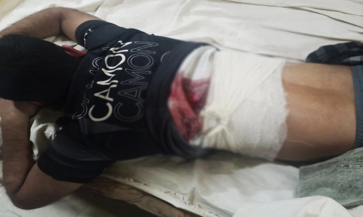 গুলিতে আহত মোবাইল ব্যবসায়ী।  ছবি: রূপালী বাংলাদেশ