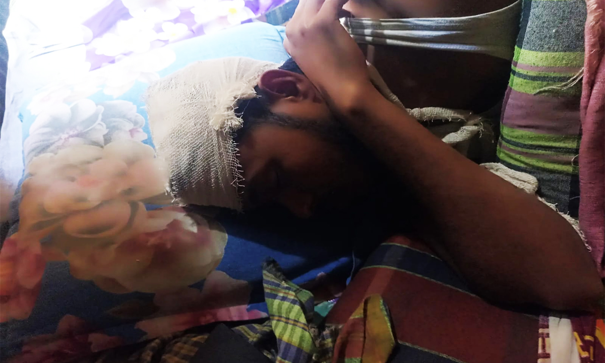 ব্যবসায়ীর বাড়িতে ডাকাতিতে আহত সদস্য। ছবি : রূপালী বাংলাদেশ