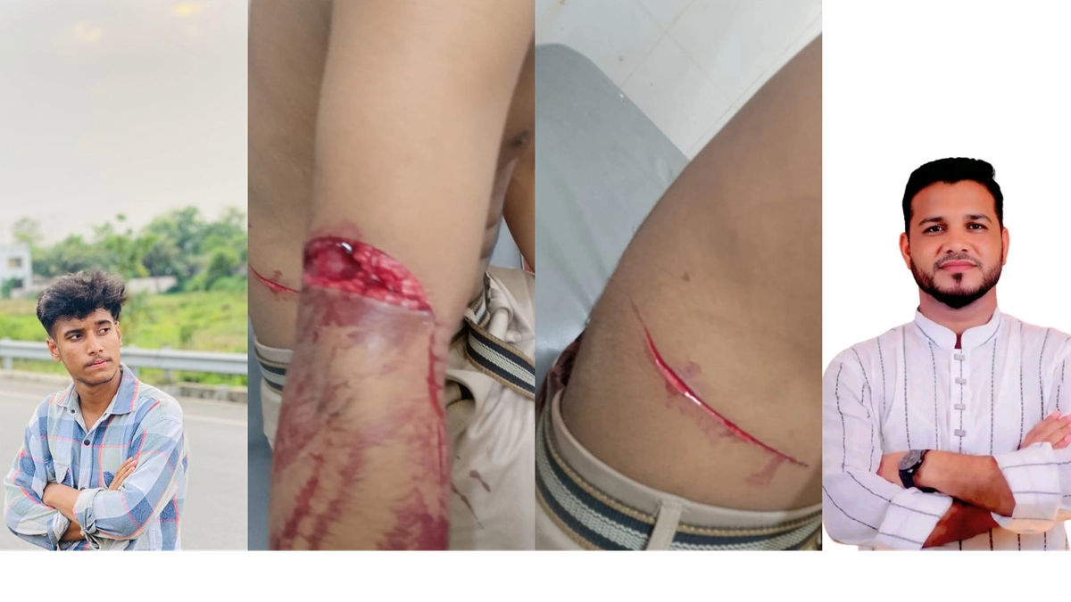 বামে আহত আবিদ ও ডানে কলেজ ছাত্রদলের সভাপতি বোরহান। ছবি : রূপালী বাংলাদেশ