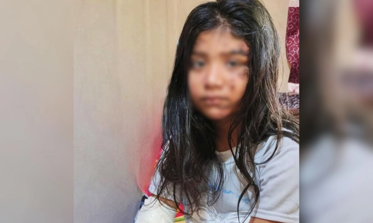 আহত ফাইজা আক্তার। ছবি : রূপালী বাংলাদেশ