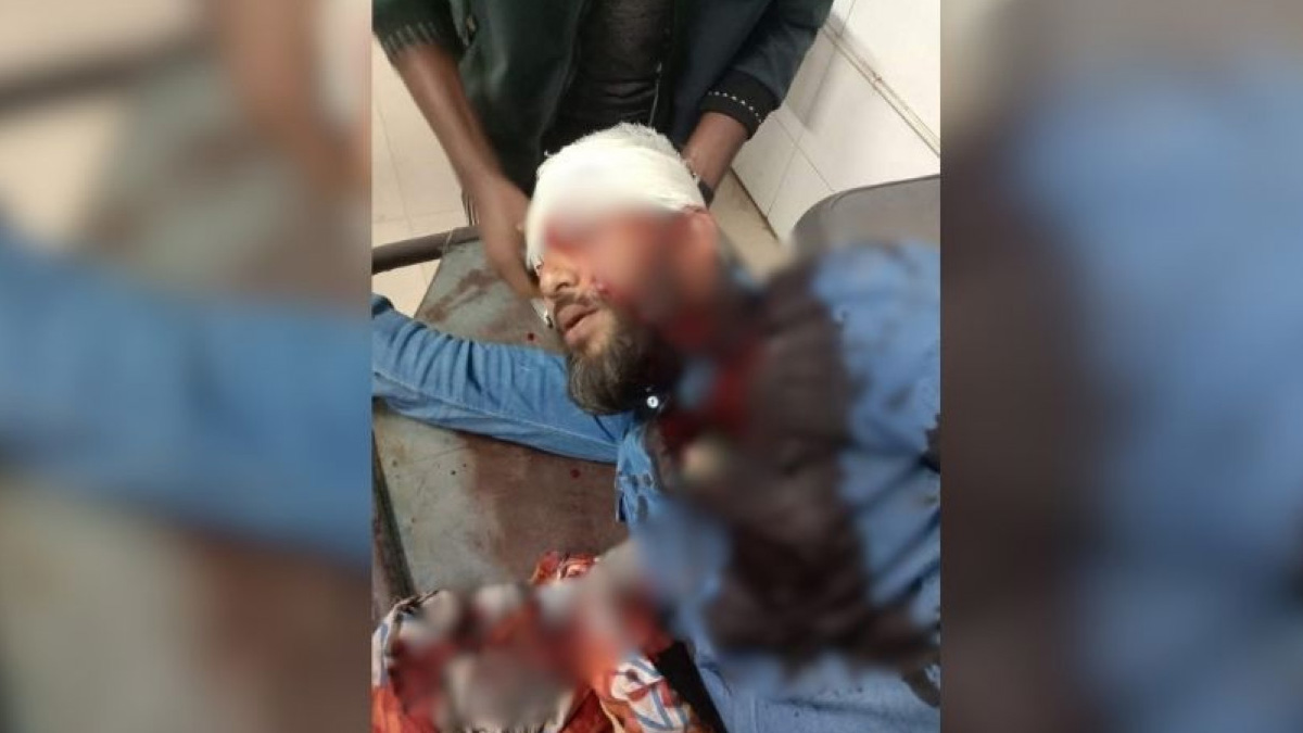 এনসিপি শ্রমিক শক্তির কেন্দ্রীয় সংগঠক মোতালেব শিকদার গুলিবিদ্ধ হয়েছেন। ছবি- সংগৃহীত