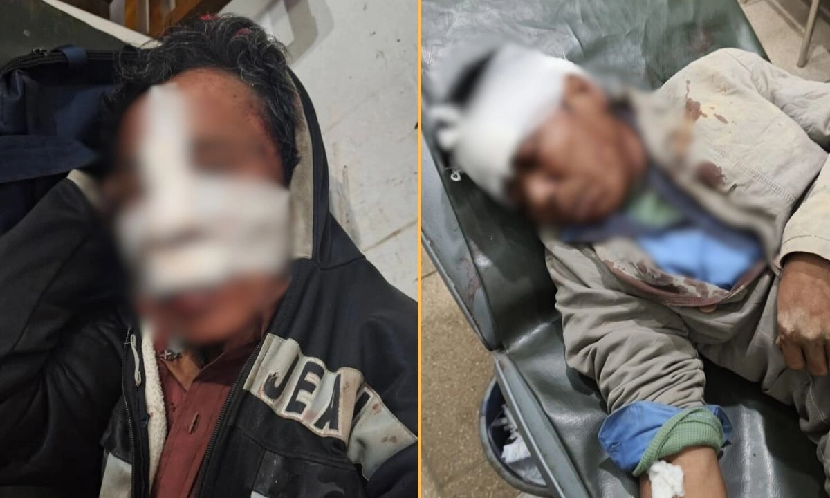 হামলায় আহতদের মধ্যে দুজন। ছবি- রূপালী বাংলাদেশ