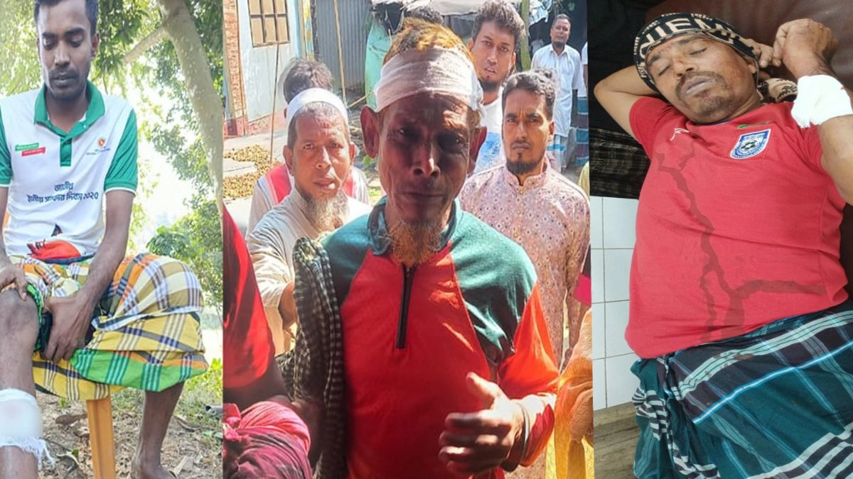 সংঘর্ষ আহতরা। ছবি- রূপালী বাংলাদেশ