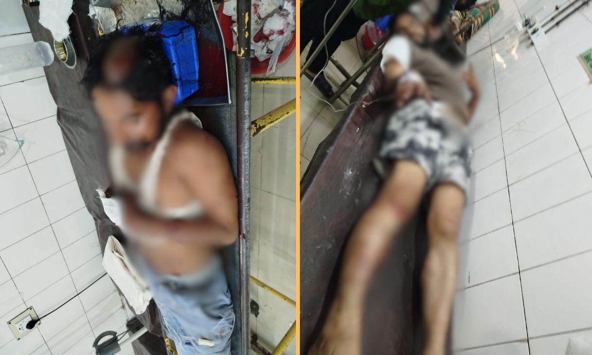 আহত দুই জন। ছবি- রূপালী বাংলাদেশ