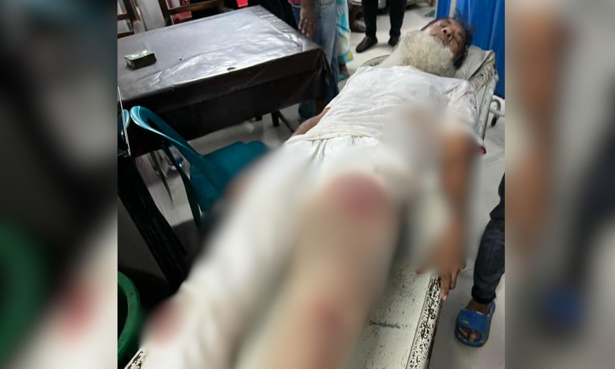 আহত শামসুদ্দোহা। ছবি- রূপালী বাংলাদেশ