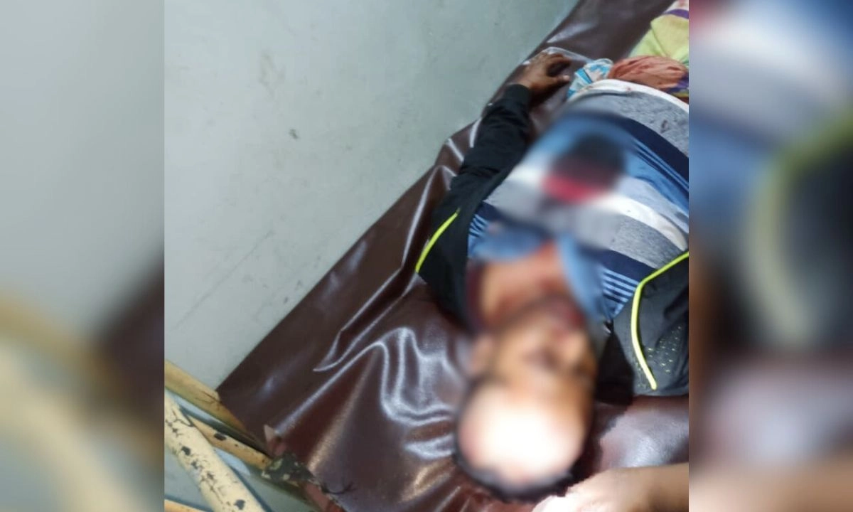 আহতদের মধ্যে একজন। ছবি : রূপালী বাংলাদেশ