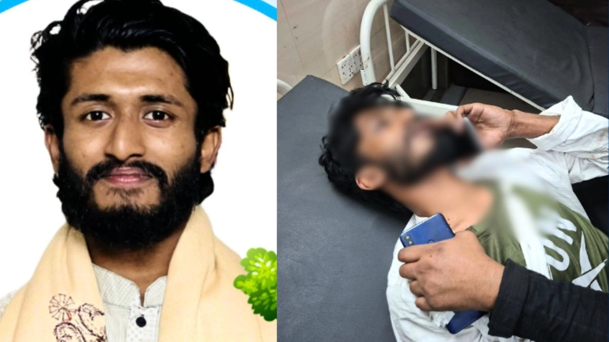 হামলার শিকার জুলাইযোদ্ধা তামিম মির্জা। ছবি : সংগৃহীত