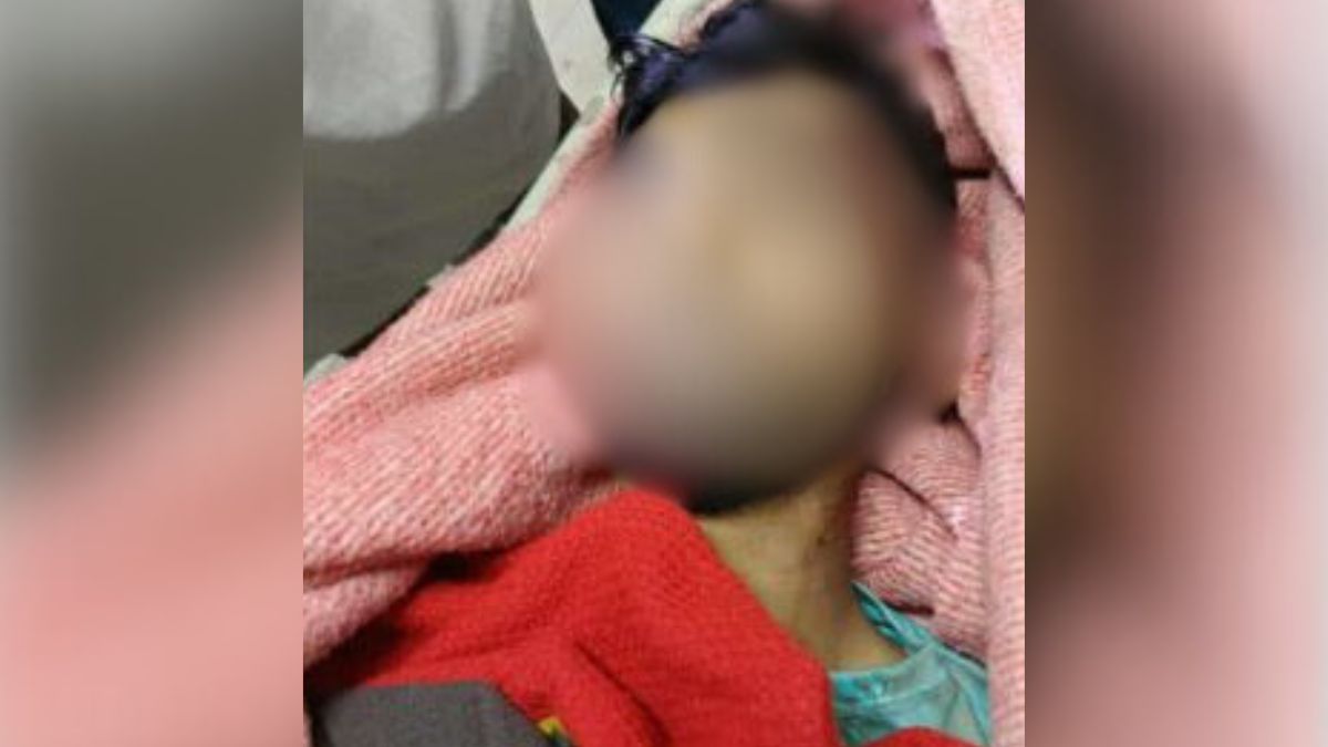 অটোরিকশা চালক ইউসুফ।