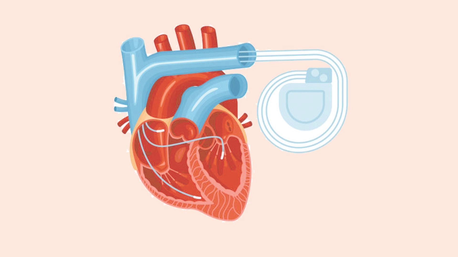ভুল করে সঠিক জিনিস আবিষ্কার